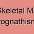 Dental Mandibular Prognathism