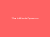 What Is Urticaria Pigmentosa
