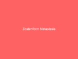 Zosteriform Metastasis